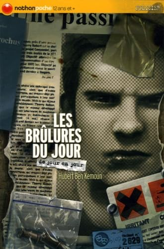 Les brûlures du jour